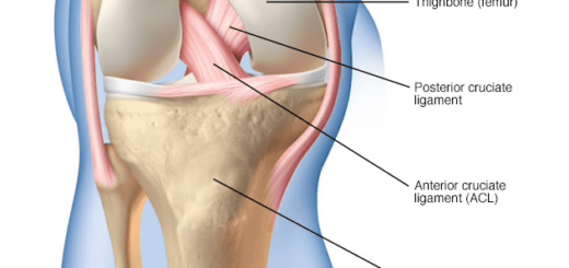 ACL Surgery