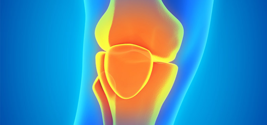 Knee Replacement Surgery by Gautam Tawari