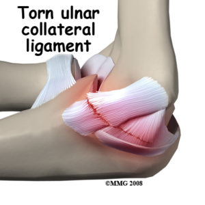 ligament Elbow